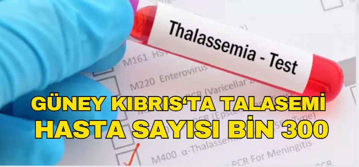 Güney Kıbrıs’ta her 7 kişiden 1'i talasemi taşıyıcısı